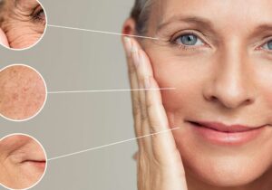 Kırışıklık Tedavisi