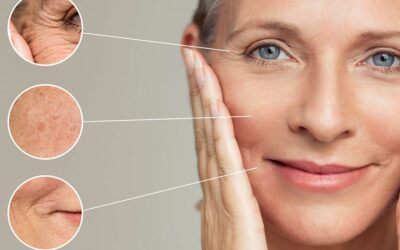 Kırışıklık Tedavisi